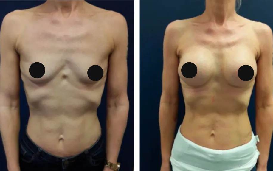 Before and after facial treatments